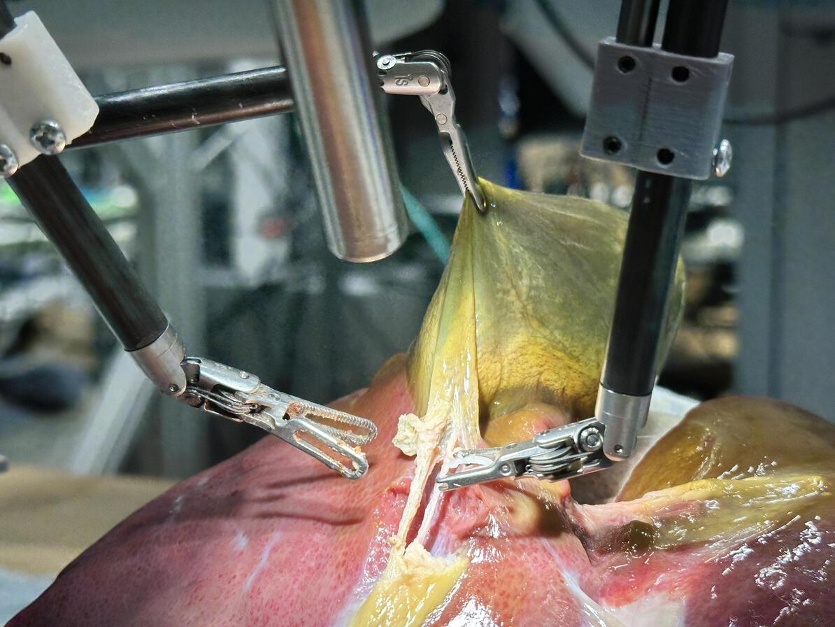 Robot performs first realistic surgery without human help